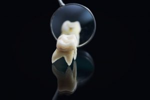 wisdom tooth magnifying glass inspection extraction